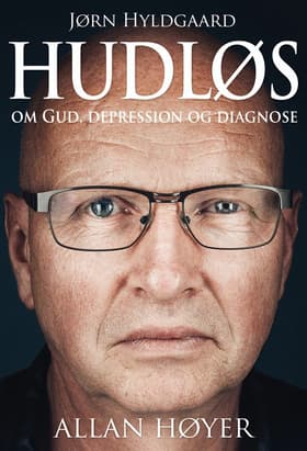 Hudløs af Allan Høyer